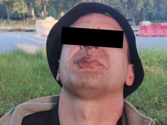 В Челябинске в ночном клубе произошла драка. В ход пошли перцовый баллон и нож охрана Челябинск Варяг ЧОП ГБР